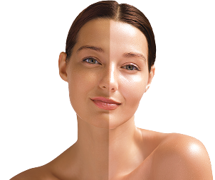 Ajută la uniformizarea tonului pielii și la iluminarea tenului